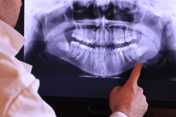 Best Dentist for Tooth Abscess  in Olivet, TN